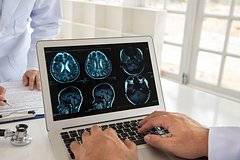 Названа неожиданная причина ускоренного старения мозга